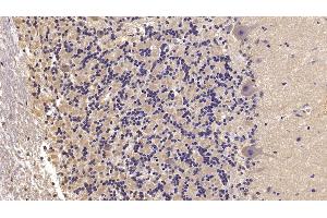 Detection of SEMA5B in Human Cerebellum Tissue using Monoclonal Antibody to Semaphorin 5B (SEMA5B) (SEMA5B Antikörper  (AA 36-602))