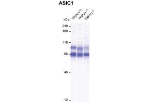 Representative digitally generated blot of ASIC1 (cat.