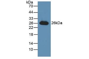 Figure. (GSTA3 Antikörper  (AA 1-222))