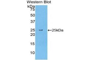 Western blot analysis of the recombinant protein. (CELA1 Antikörper  (AA 44-259))