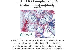Image no. 1 for anti-Complement Component 6 (C6) antibody (ABIN1723410)
