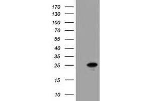 Western Blotting (WB) image for anti-Adenylate Kinase 3 (AK3) antibody (ABIN1496520) (Adenylate Kinase 3 Antikörper)