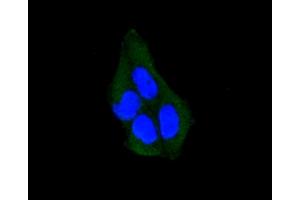 Immunofluorescence analysis of HeLa cells using ARRB1 antibody (ABIN5996907). (beta Arrestin 1 Antikörper)