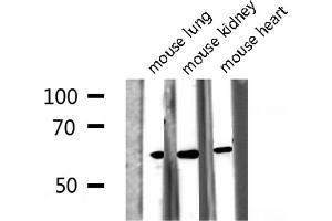 Western blot analysis of Phospho-Src (Tyr418) expression in various lysates (Src Antikörper  (pTyr419))