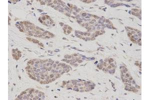 Immunohistochemistry (IHC) image for anti-Thymopoietin (TMPO) antibody (ABIN1875122) (Thymopoietin Antikörper)