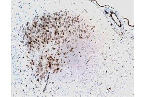 Immunohistochemical staining of neurons and endothelial cells from blood vessels (formalin-fixed, citrate buffer pre-treatment, 10X). (PTGS2 Antikörper  (AA 368-604))