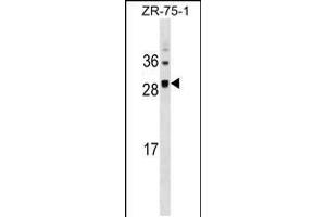 Western blot analysis in ZR-75-1 cell line lysates (35ug/lane). (SPC25 Antikörper  (AA 87-114))