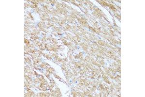 Immunohistochemistry (Paraffin-embedded Sections) (IHC (p)) image for anti-Cytochrome C, Somatic (CYCS) (AA 1-105) antibody (ABIN6139304)