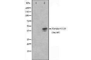 Western blot analysis on Jurkat cell lysate using Phospho-CCR5(Ser349) Antibody. (CCR5 Antikörper  (pSer349))