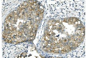 IHC analysis of BubR1/BUB1B using anti-BubR1/BUB1B antibody (ABIN7600960). (BUB1B Antikörper  (AA 26-448))