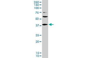 LHX6 monoclonal antibody (M01), clone 3D9. (LHX6 Antikörper  (AA 274-363))