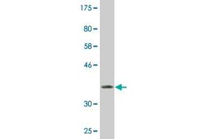 Western Blotting (WB) image for anti-Nuclear Receptor Subfamily 0, Group B, Member 1 (NR0B1) (AA 361-470) antibody (ABIN513191)