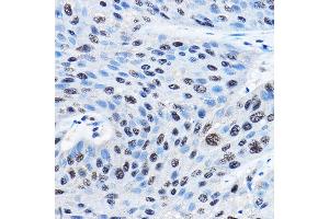 Immunohistochemistry (IHC) image for anti-Nudix (Nucleoside Diphosphate Linked Moiety X)-Type Motif 21 (NUDT21) (AA 1-227) antibody (ABIN1681134)