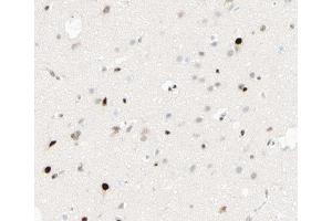 ABIN6267413 at 1/100 staining human brain tissue sections by IHC-P. (CEBPB Antikörper  (pThr235))