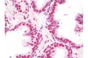 Anti-NELFA / WHSC2 antibody IHC staining of human prostate. (WHSC2 Antikörper  (AA 280-511))