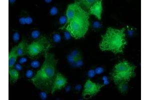 Immunofluorescence (IF) image for anti-Calcium Binding and Coiled-Coil Domain 2 (CALCOCO2) antibody (ABIN1497076) (CALCOCO2 Antikörper)