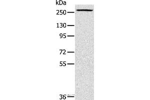 Western blot analysis of Huvec cell, using TLN1 Polyclonal Antibody at dilution of 1:200 (TLN1 Antikörper)
