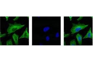 IF analysis of Hela with antibody (Left) and DAPI (Right) diluted at 1:100. (TUBB3 Antikörper)