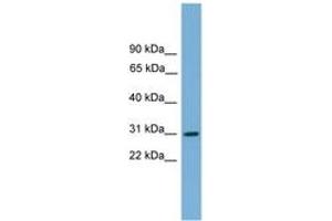 Image no. 1 for anti-Major Histocompatibility Complex, Class II, DQ alpha 2 (HLA-DQA2) (AA 71-120) antibody (ABIN6744867) (HLA-DQA2 Antikörper  (AA 71-120))