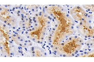 Immunohistochemistry (IHC) image for anti-Caspase 8 (CASP8) (AA 385-479) antibody (ABIN7437074)