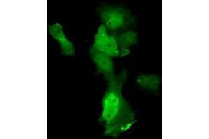 Anti-ANXA11 mouse monoclonal antibody (ABIN2452757) immunofluorescent staining of COS7 cells transiently transfected by pCMV6-ENTRY ANXA11 (RC212191). (Annexin A11 Antikörper)