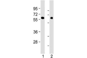 Western blot testing of human 1) kidney and 2) lung tissue lysate with MKS1 antibody at 1:2000. (MKS1 Antikörper  (N-Term))