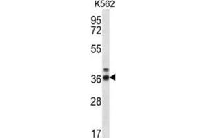 Western Blotting (WB) image for anti-Ribonuclease P/MRP 38kDa Subunit (RPP38) antibody (ABIN2996921) (RPP38 Antikörper)