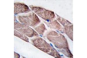Image no. 2 for anti-Epilepsy, Progressive Myoclonus Type 2A, Lafora Disease (Laforin) (EPM2A) (C-Term) antibody (ABIN356954) (EPM2A Antikörper  (C-Term))
