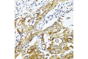 Immunohistochemistry (Paraffin-embedded Sections) (IHC (p)) image for anti-Solute Carrier Family 2 (Facilitated Glucose Transporter), Member 4 (SLC2A4) (C-Term) antibody (ABIN6147963)