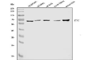 Western blot analysis of ATIC using anti-ATIC antibody (ABIN7601511).