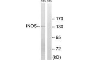 Western blot analysis of extracts from NIH-3T3 cells, using iNOS (Ab-151) Antibody. (NOS2 Antikörper  (AA 117-166))