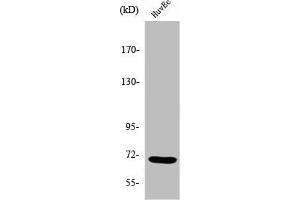 Western Blot analysis of COLO205 cells using Sam 68 Polyclonal Antibody (KHDRBS1 Antikörper  (Internal Region))