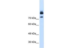 Western Blotting (WB) image for anti-Myotubularin Related Protein 1 (MTMR1) antibody (ABIN2462536)