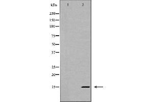 Western blot analysis of Interleukin 5 expression in HT-29 cells,The lane on the left is treated with the antigen-specific peptide. (IL-5 Antikörper  (Internal Region))