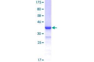 ITCH Protein (AA 92-190) (GST tag)