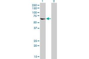 Western Blotting (WB) image for anti-Vacuolar Protein Sorting 72 Homolog (S. Cerevisiae) (VPS72) (AA 1-364) antibody (ABIN520787)