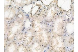 ABIN6258035 and ABIN6275789 at 1/100 staining human normal kidney tissue by IHC-P. (CSRNP2 Antikörper  (Internal Region))