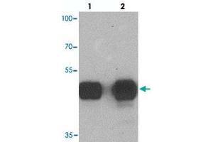 Western blot analysis of TUBA3C in mouse brain tissue with TUBA3C polyclonal antibody  at (lane 1) 0. (TUBA3C Antikörper  (N-Term))