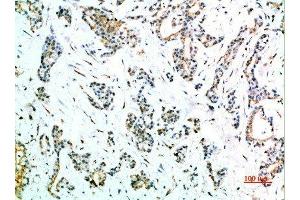 Immunohistochemistry (IHC) image for anti-Fc Fragment of IgG, High Affinity Ia, Receptor (CD64) (FCGR1A) (AA 230-280) antibody (ABIN7189472)