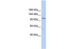TRPC3 antibody used at 1 ug/ml to detect target protein. (TRPC3 Antikörper  (N-Term))
