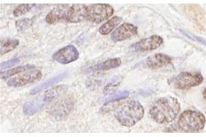 Immunohistochemistry (IHC) image for anti-Ataxia Telangiectasia Mutated (ATM) (AA 2550-2600) antibody (ABIN7448423) (ATM Antikörper  (AA 2550-2600))