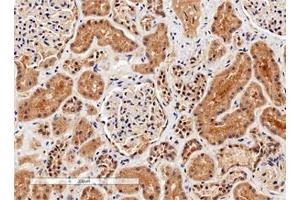 IHC testing of FFPE human kidney tissue with Arginase 1 antibody. (Liver Arginase Antikörper)