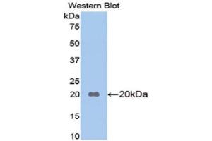 Western Blotting (WB) image for anti-Apolipoprotein B (APOB) (AA 3360-3526) antibody (ABIN1715286) (APOB Antikörper  (AA 3360-3526))