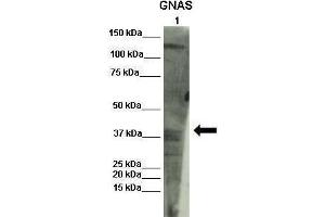 Lanes :  Lane 1: INS1 lysate   Primary Antibody Dilution :   1:1000    Secondary Antibody :  Donkey anti-rabbit-HRP   Secondary Antibody Dilution :   1:1000   Gene Name :  GNAS   Submitted by :  Olivier Costa, Diabetes research center VUB