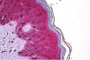 Human Skin: Formalin-Fixed, Paraffin-Embedded (FFPE) (TRIM29 Antikörper  (AA 295-306))