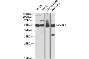 Western blot analysis of extracts of various cell lines, using C4BPB antibody (ABIN6127735, ABIN6137775, ABIN6137776 and ABIN6221978) at 1:1000 dilution. (C4BPB Antikörper  (AA 18-251))