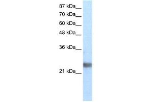 WB Suggested Anti-ZNF313 Antibody Titration: 1. (RNF114 Antikörper  (N-Term))