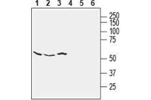 Western blot analysis of human SH-SY5Y neuroblastoma (lanes 1 and 4), human HT-29 colon adenocarcinoma (lanes 2 and 5) and human MCF-7 breast adenocarcinoma (lanes 3 and 6) cell line lysates: - 1-3. (NETO2 Antikörper  (Extracellular))