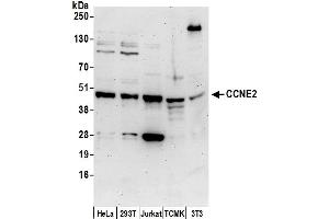Western Blotting (WB) image for anti-Cyclin E2 (CCNE2) (AA 354-404) antibody (ABIN7450083)