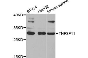 Western blot analysis of extracts of various cell lines, using TNFSF11 antibody (ABIN5971376) at 1/1000 dilution. (RANKL Antikörper)